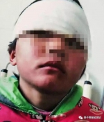 网曝射阳8岁女学生遭老师殴打 右眉缝4针 - 新浪江苏