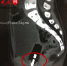 CT片子显示，9岁女童乐乐的下体内有一个长条形的异物。 刘威摄 - 新浪江苏