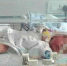 ↑被遗弃的女婴正在接受治疗 警方供图 - 新浪江苏