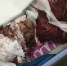 　　伤者躺在病床上接受医生抢救。受访者供图 - 新浪江苏